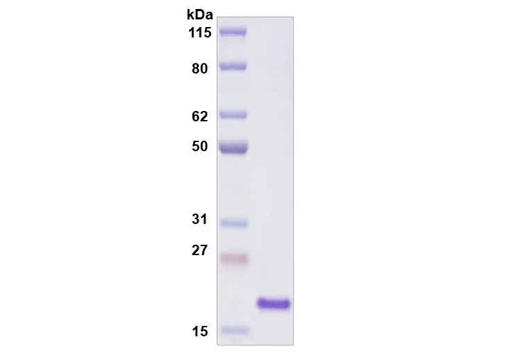 Recombinant Human Siglec-9, His Tag -25 ug